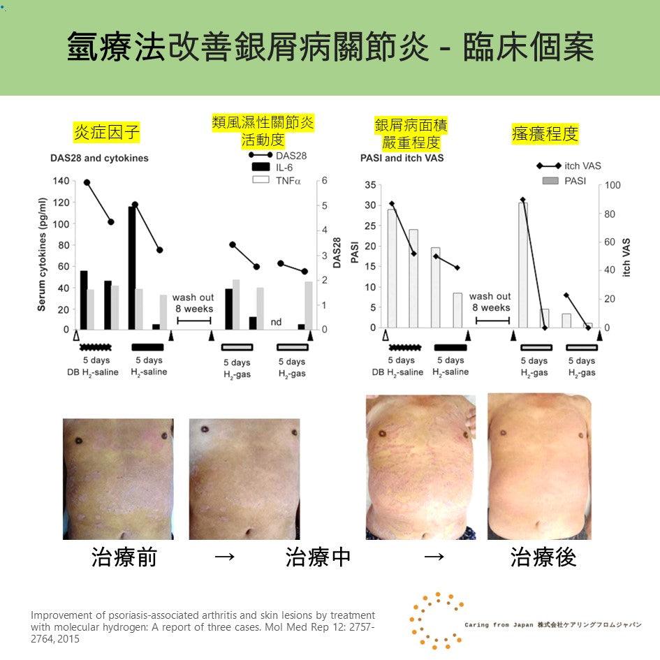 銀屑病關節炎: 氫療法臨床個案