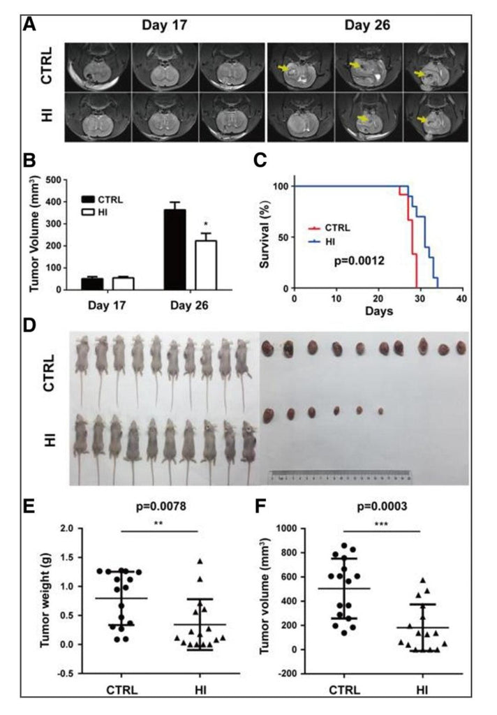 腦癌:吸入氫氣抑制腦癌生長