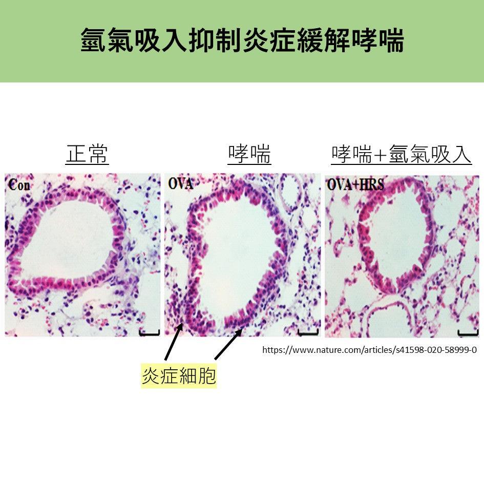 氫氣吸入抑制炎症緩解哮喘