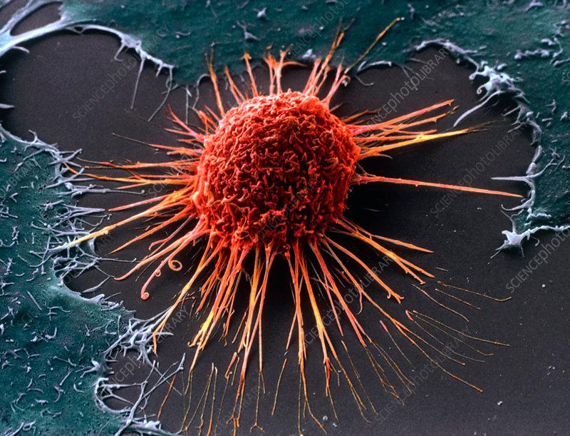 癌細胞和正常細胞不一樣的地方是什麼?