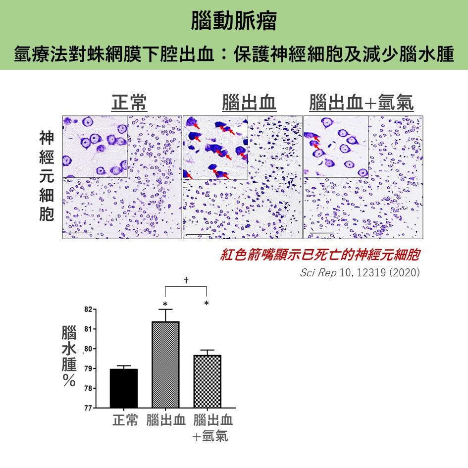 氫療法減少腦動脈瘤出血引起的腦水腫及神經元細胞死亡率