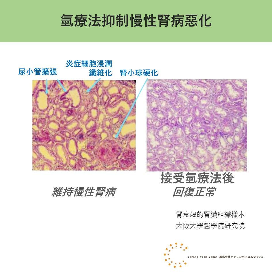 氫療法抑制腎衰竭實驗